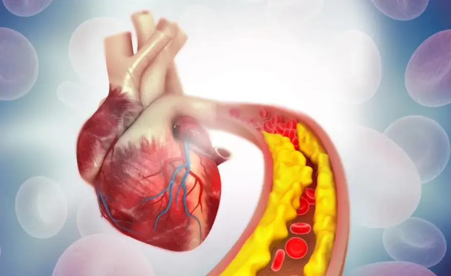 Cholesterol nie-HDL - Nie ma jednej normy! Sprawdź swoją