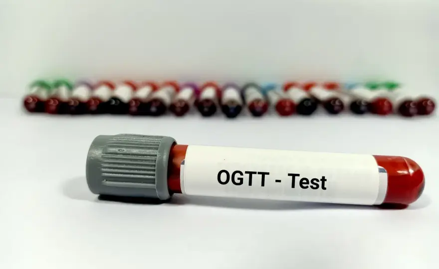 Doustny test obciążenia glukozą - Jak interpretować wyniki?