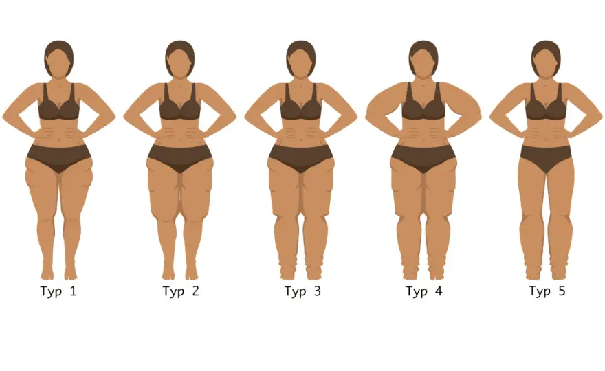 Lipedema - Jak prawidłowo diagnozować i czytać wyniki badań?