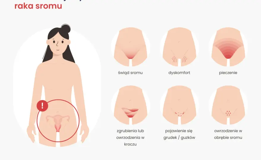 Rak sromu - objawy. Kiedy to nie infekcja? Sprawdź!
