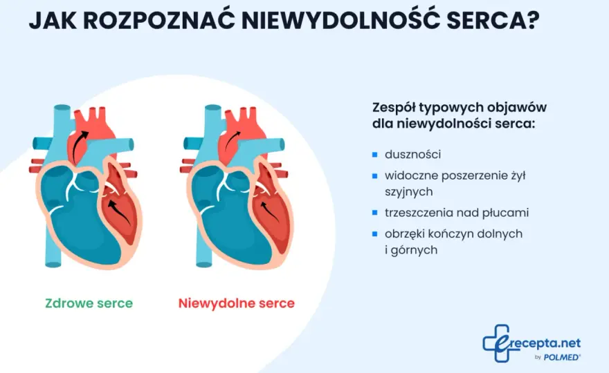 Niewydolność krążenia - objawy, które łatwo przeoczyć