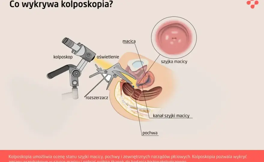 Cytologia, HPV, kolposkopia - Jak czytać wyniki badań szyjki macicy?
