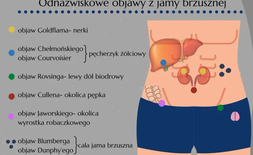 Objaw Jaworskiego - co oznacza? Zapalenie wyrostka?
