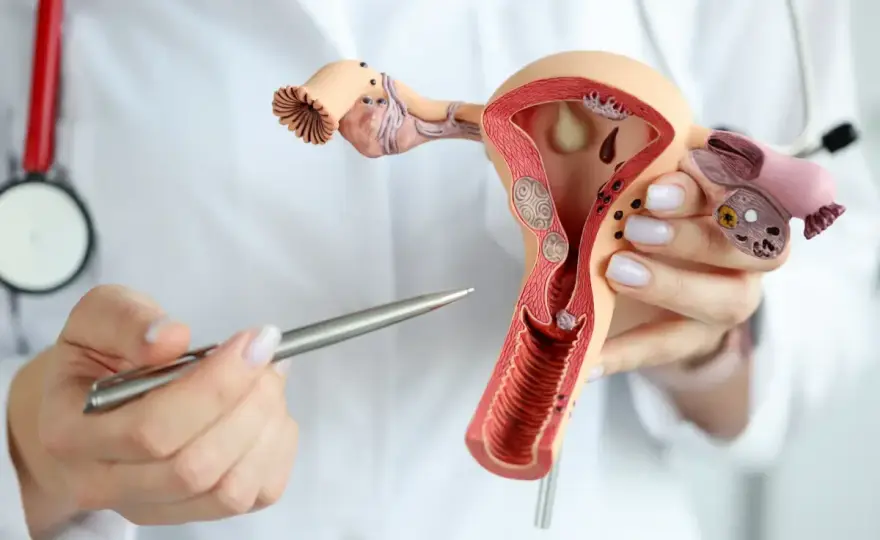 Rak endometrium - objawy, diagnoza i leczenie