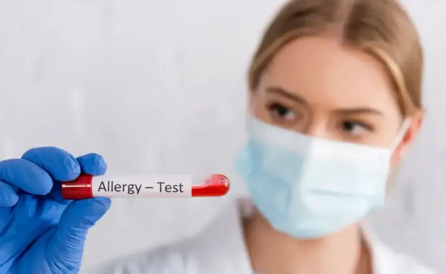 Testy alergiczne z krwi - kiedy mają sens i jak czytać wynik