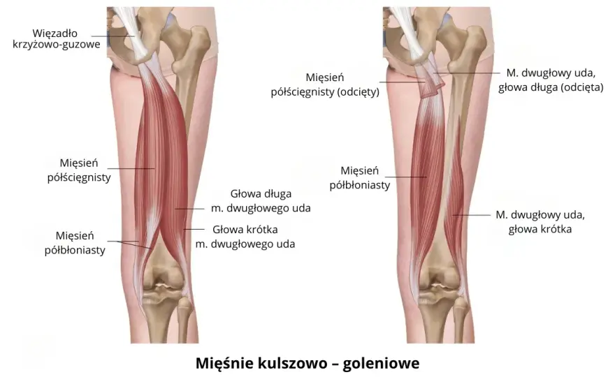 Mięśnie nóg: Anatomia, bóle, urazy i jak o nie dbać