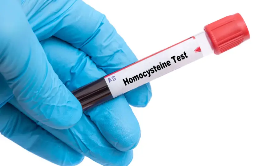 Homocysteina - co oznacza wynik? Kiedy badać i jak czytać