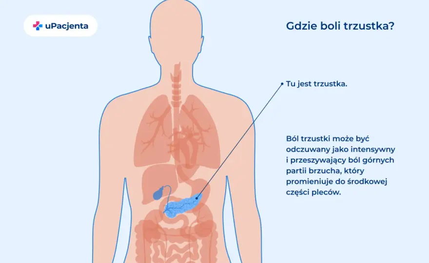 Gdzie boli trzustka? Lokalizacja, promieniowanie i objawy
