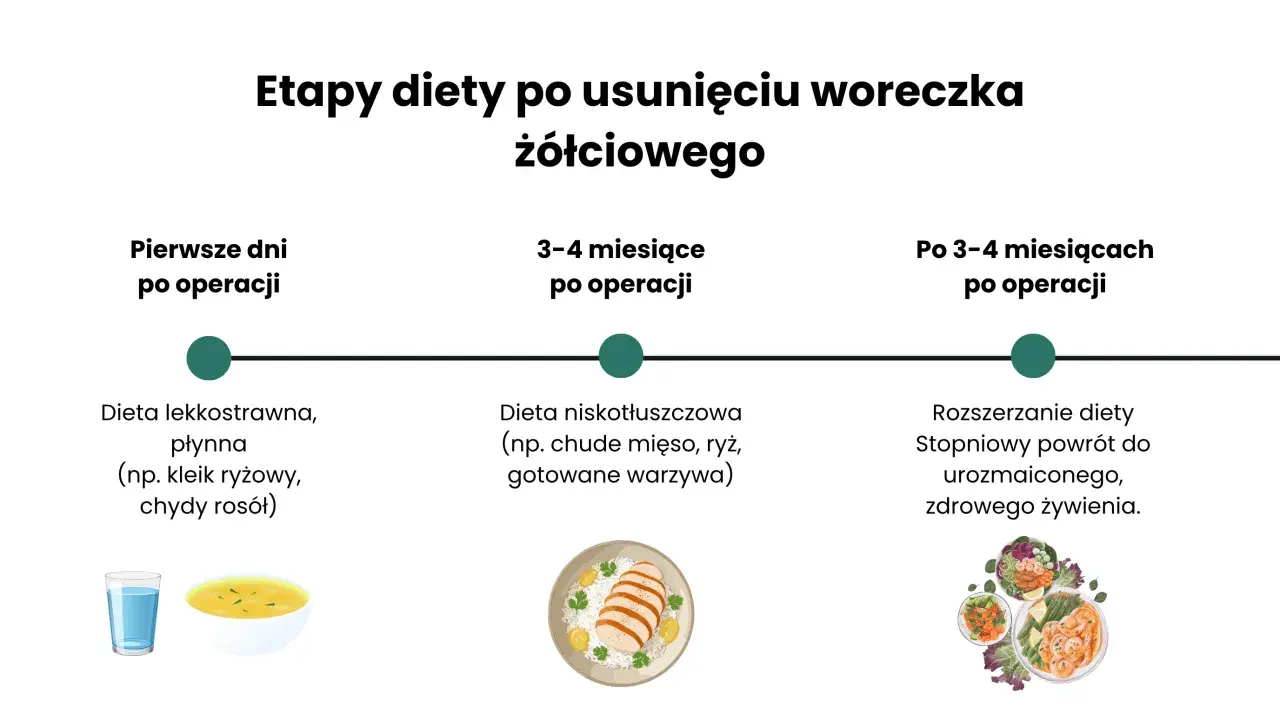 Jadłospis tygodniowy po usunięciu woreczka żółciowego: etapy diety - lekkostrawna, niskotłuszczowa, rozszerzona.
