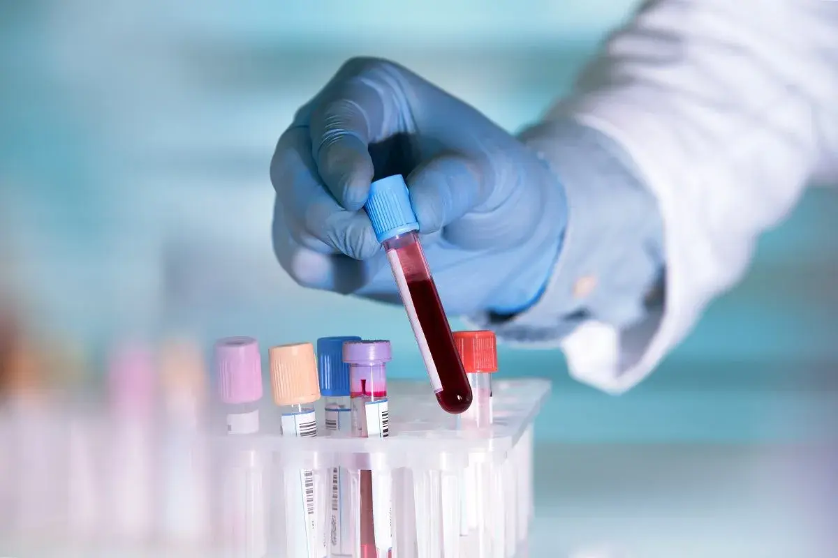 Ręka w niebieskiej rękawiczce trzyma probówkę z krwią. Badanie lipoproteiny a co to jest, kluczowe dla zdrowia serca.