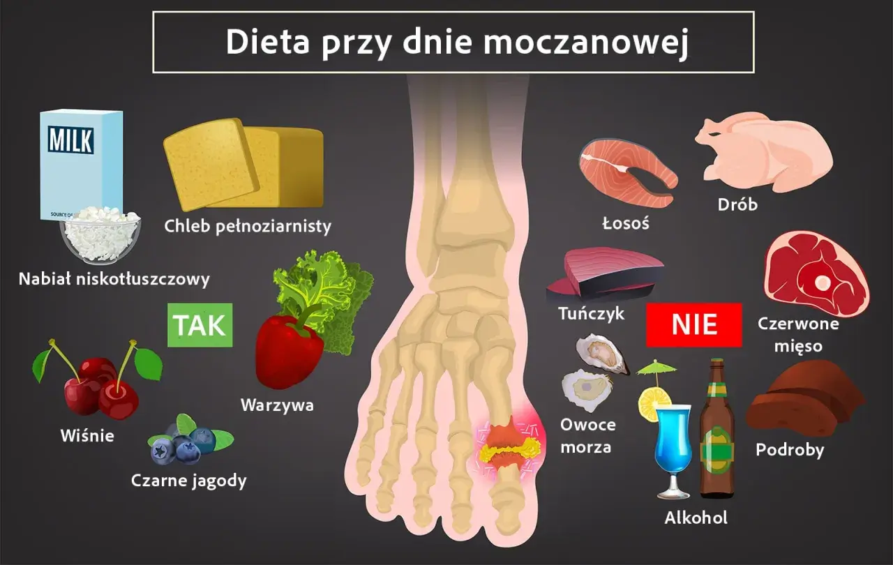 Dieta przy dnie moczanowej: TAK - nabiał, chleb, warzywa, wiśnie, jagody. NIE - drób, łosoś, tuńczyk, czerwone mięso, podroby, owoce morza, alkohol.