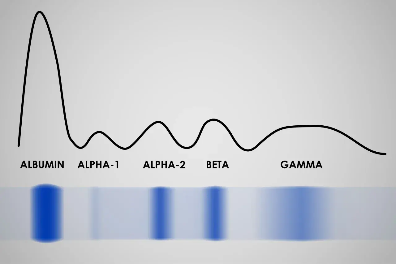 Wykres proteinogramu z frakcjami: albuminy, alfa-1, alfa-2, beta i gamma.