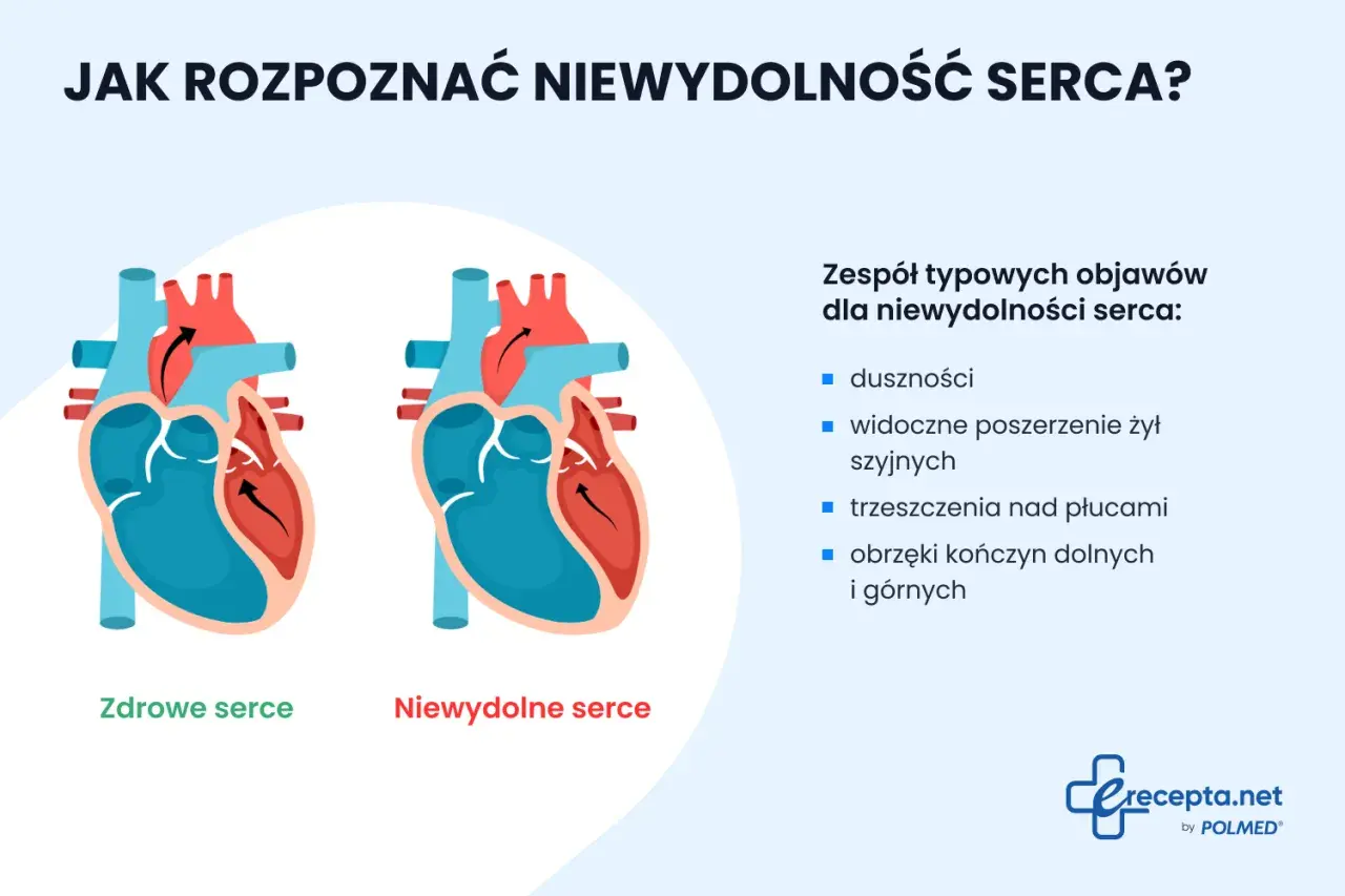 Ilustracja porównuje zdrowe serce z niewydolnym, wymieniając objawy niewydolności krążenia: duszności, obrzęki.