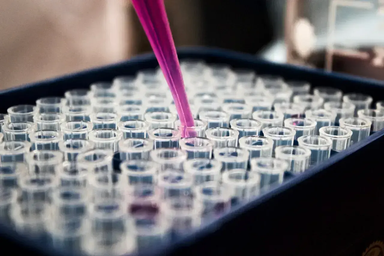 Różowa pipeta pobiera próbkę do jednego z wielu przezroczystych naczyń w laboratorium. To praca, która może pomóc patomorfologowi w diagnozie.