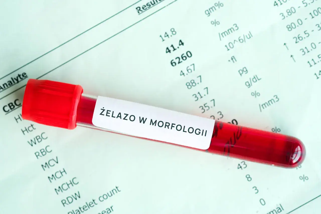 Czerwona probówka z krwią na tle wyników badań laboratoryjnych. Etykieta na probówce informuje o badaniu "ŻELAZO W MORFOLOGII".
