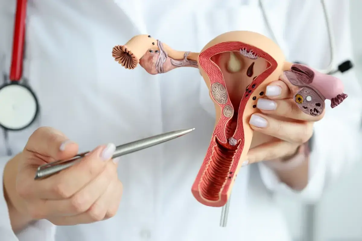Model narządu rodnego kobiety z widocznymi zmianami, które mogą sugerować raka endometrium. Lekarz wskazuje na nie długopisem.