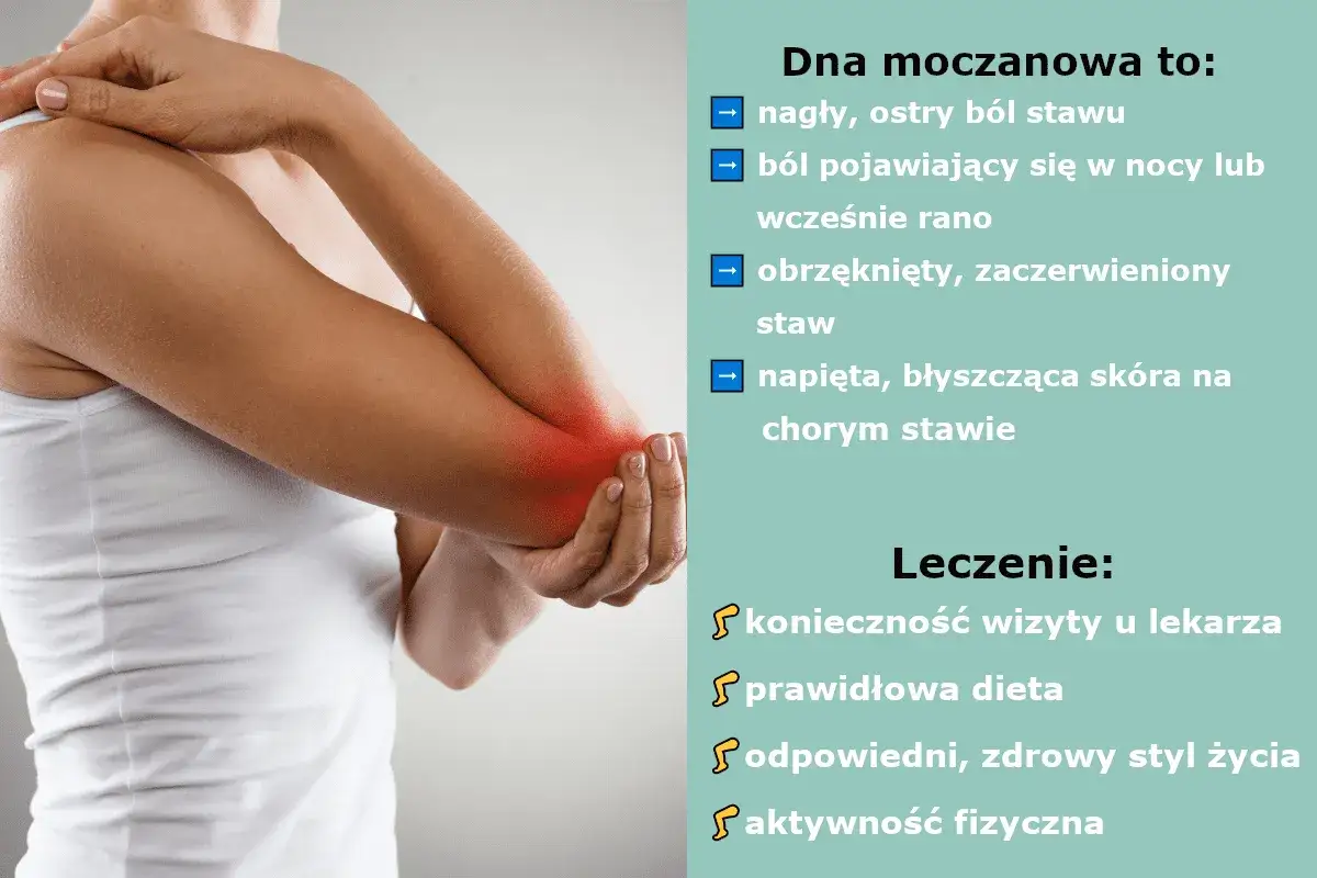 Dna moczanowa objawia się nagłym bólem stawu, obrzękiem i zaczerwienieniem. Leczenie obejmuje wizytę u lekarza, dietę i zdrowy styl życia.