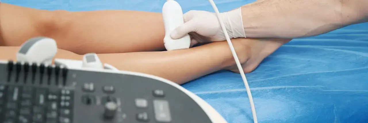 Badanie USG nogi w celu diagnostyki lipedema.