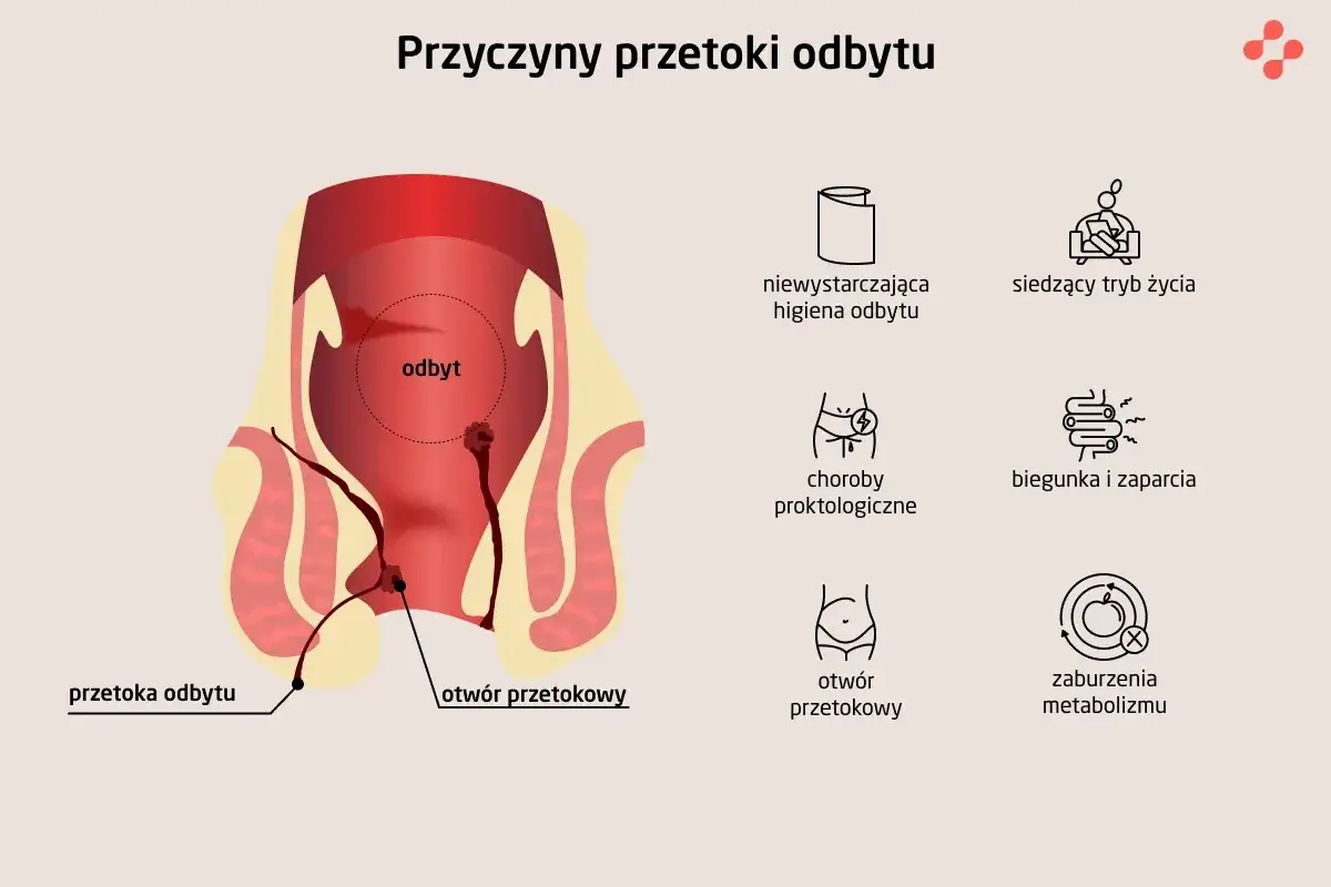 Ilustracja przedstawia anatomię odbytu i jego okolicy, ukazując przetokę odbytu. Obok znajdują się ikony symbolizujące przyczyny: zła higiena, siedzący tryb życia, choroby proktologiczne, biegunka i zaparcia, otwór przetokowy oraz zaburzenia metabolizmu.