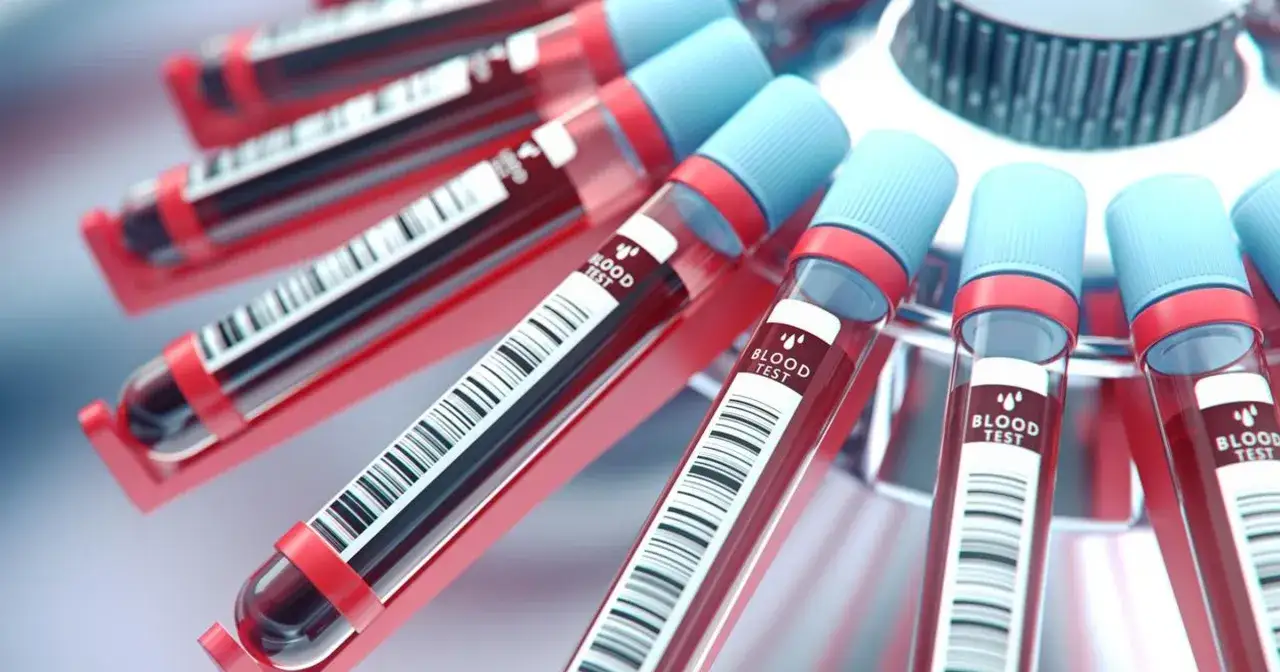 Próbówki z krwią w wirówce laboratoryjnej. To właśnie rf co to za badanie, czyli analiza próbek krwi.