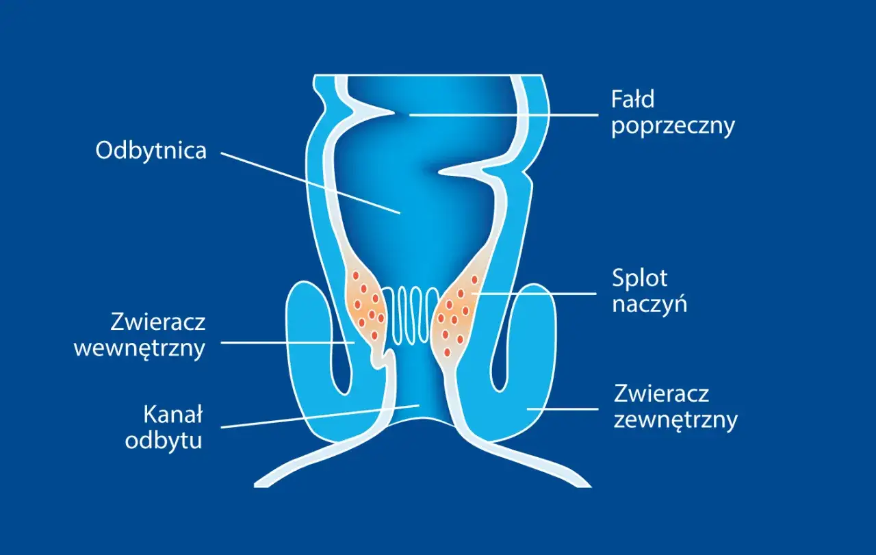 Anatomia odbytu z zaznaczonym splotem naczyń, który może być przyczyną objawów hemoroidów.