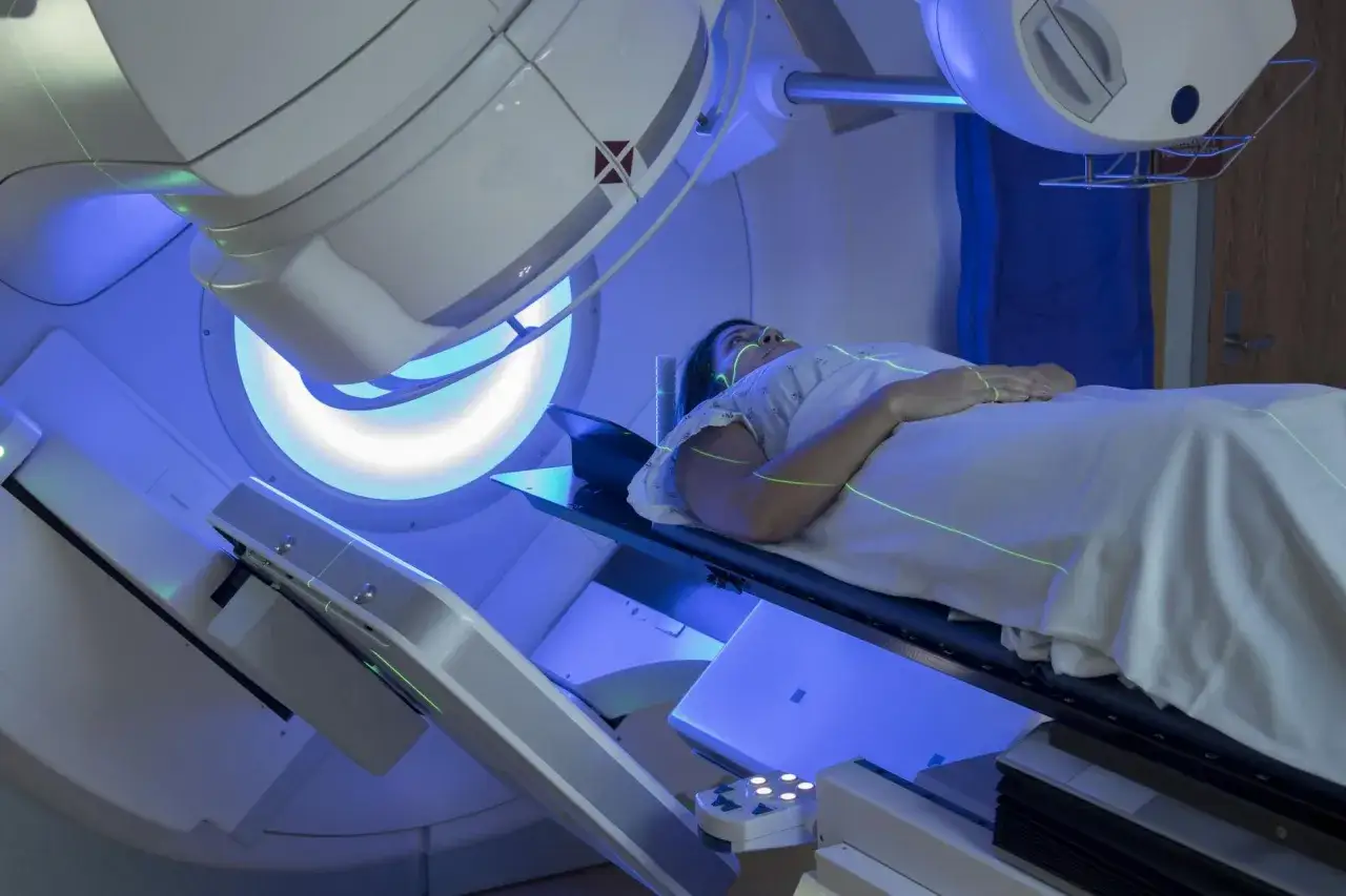 Pacjentka leży na stole pod aparatem do radioterapii. Zielone linie laserowe wyznaczają pole zabiegu. To przykład, jak wygląda radioterapia co to za leczenie.