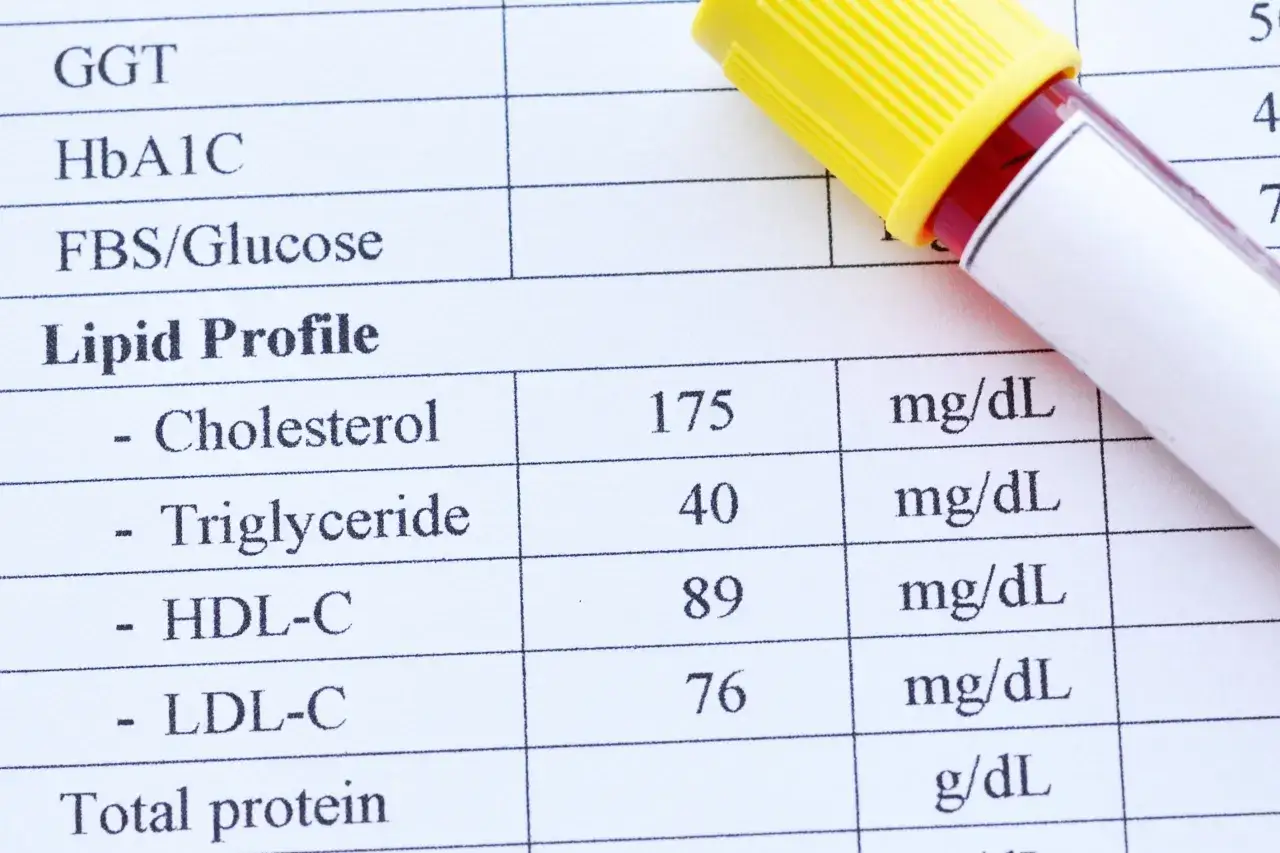Wynik lipidogramu: cholesterol 175 mg/dL, HDL 89 mg/dL, LDL 76 mg/dL. Sprawdzam, czy cholesterol nie HDL norma jest zachowana.