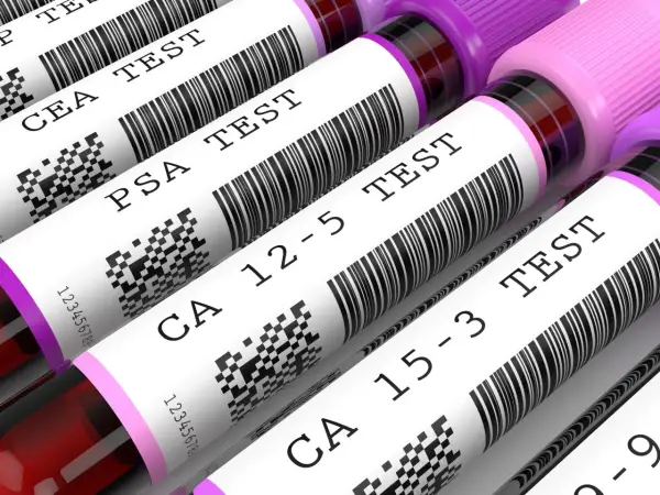 Zestaw badań markery nowotworowe: CEA, PSA, CA 12-5, CA 15-3. Sprawdź pakiet cena.