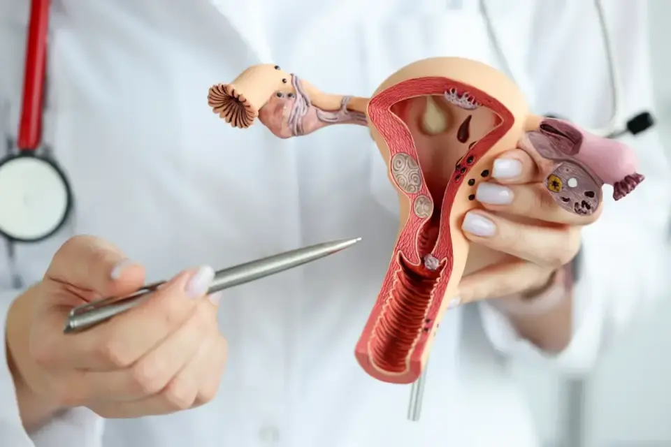 Rak endometrium - objawy, diagnoza i leczenie